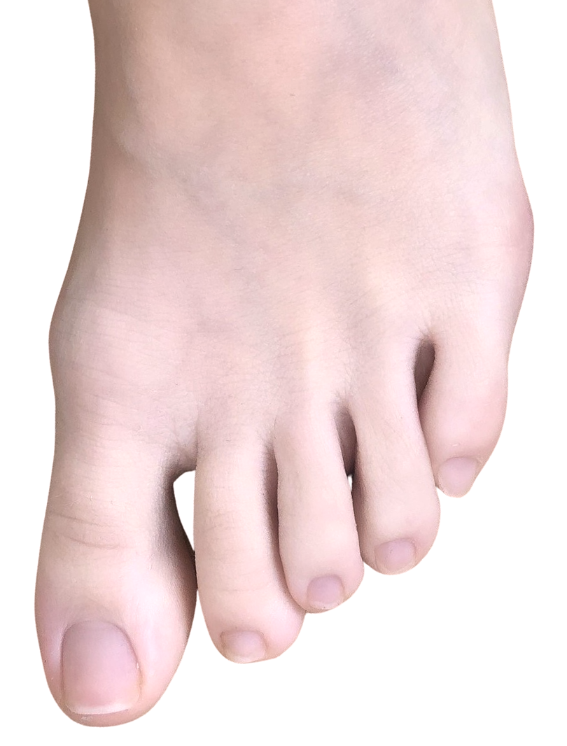 picture of a foot